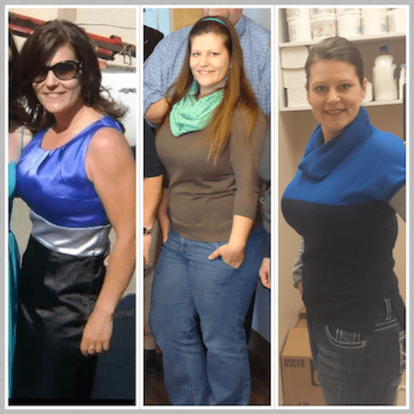 before and after hypothyroidism treatment photos