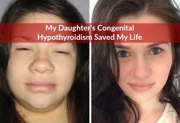 My Daughter's Congenital Hypothyroidism Saved My Life