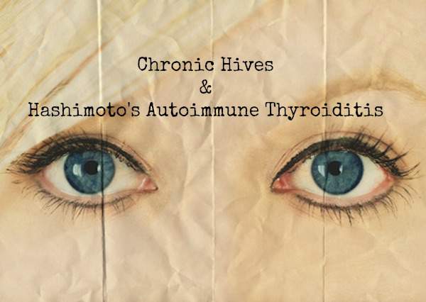 Chronic Hives and Hashimoto's Autoimmune Thyroiditis | Hypothyroid Mom