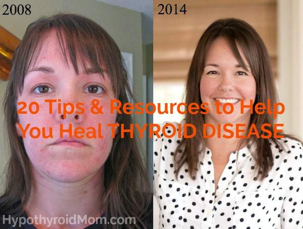 20 tips and resources to help you heal thyroid disease