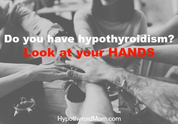 Do you have hypothyroidism? Look at your hands - Hypothyroid Mom