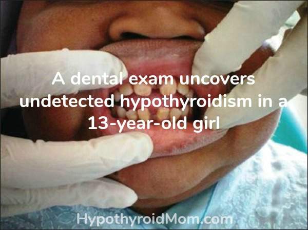 A dental exam uncovers undetected hypothyroidism in a 13-year-old girl