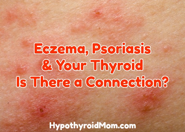 Eczema, Psoriasis & Your Thyroid: Is There a Connection?