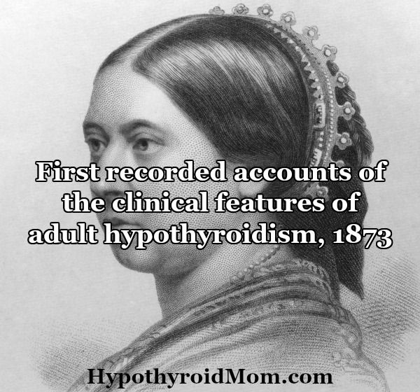 First recorded account of clinical features of adult hypothyroidism 1873