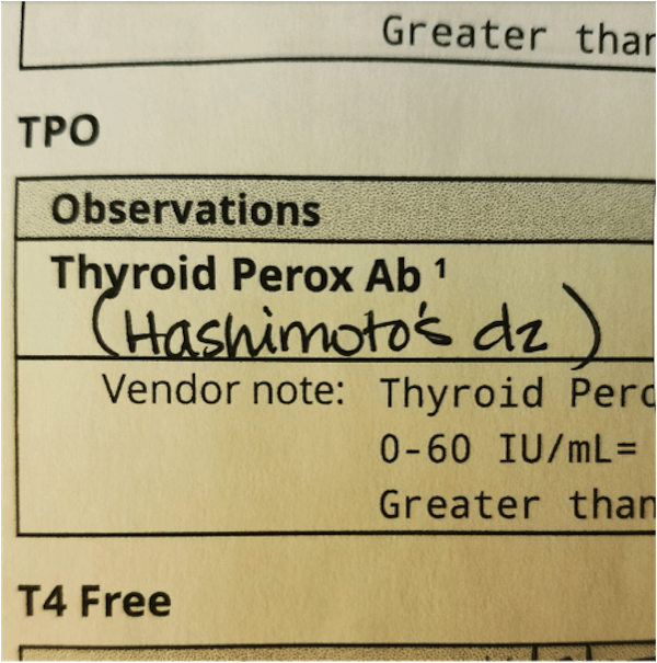 Low-dose Naltrexone for Hashimoto's. A Game Changer.