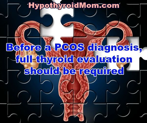 Before a PCOS diagnosis, full thyroid evaluation should be required