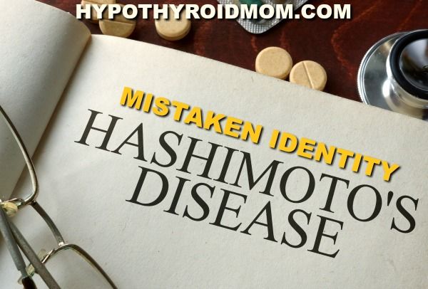 Hashimoto's Thyroiditis: A Case of Immunological Mistaken Identity