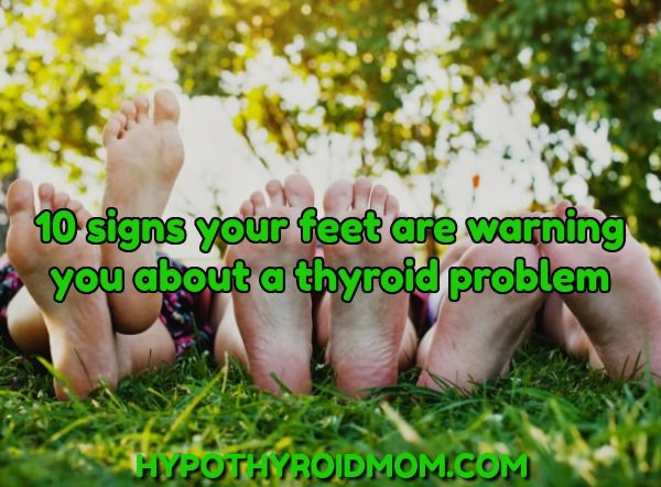 10 Signs Your Feet Are Warning You About A Thyroid Problem Hypothyroid Mom