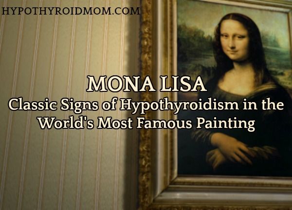 Mona Lisa: Classic Signs of Hypothyroidism In The World’s Most Famous Painting