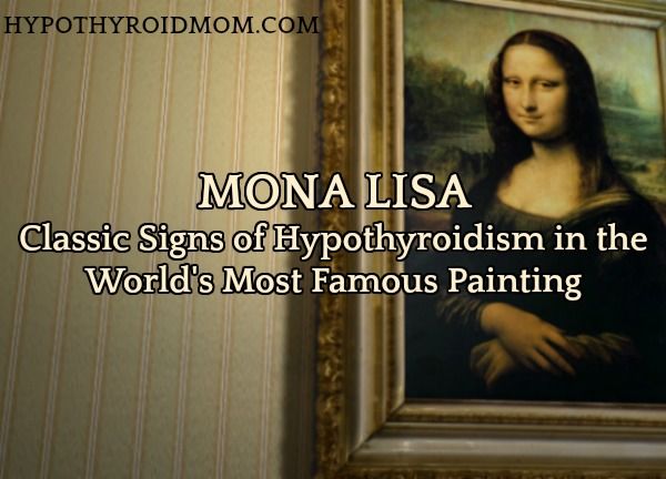 Mona Lisa: Classic Signs of Hypothyroidism in the World's Most