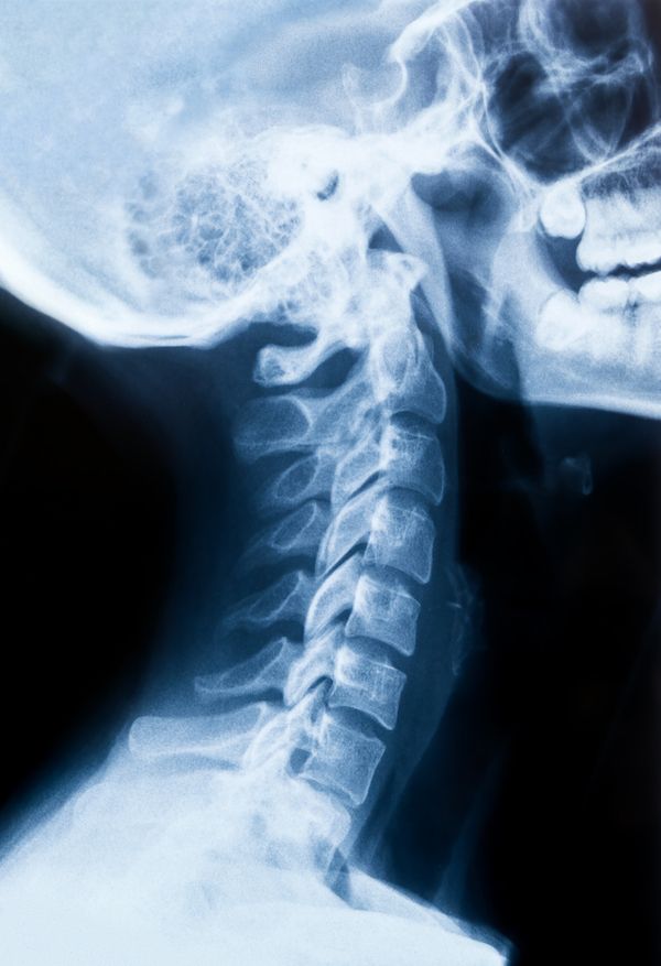 cervical spine and thyroid