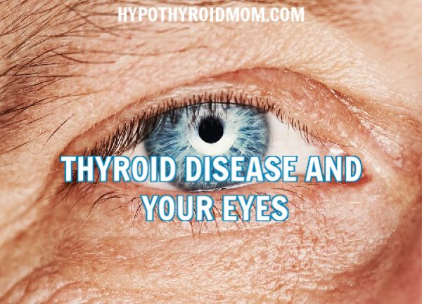Thyroid Disease And Your Eyes Hypothyroid Mom