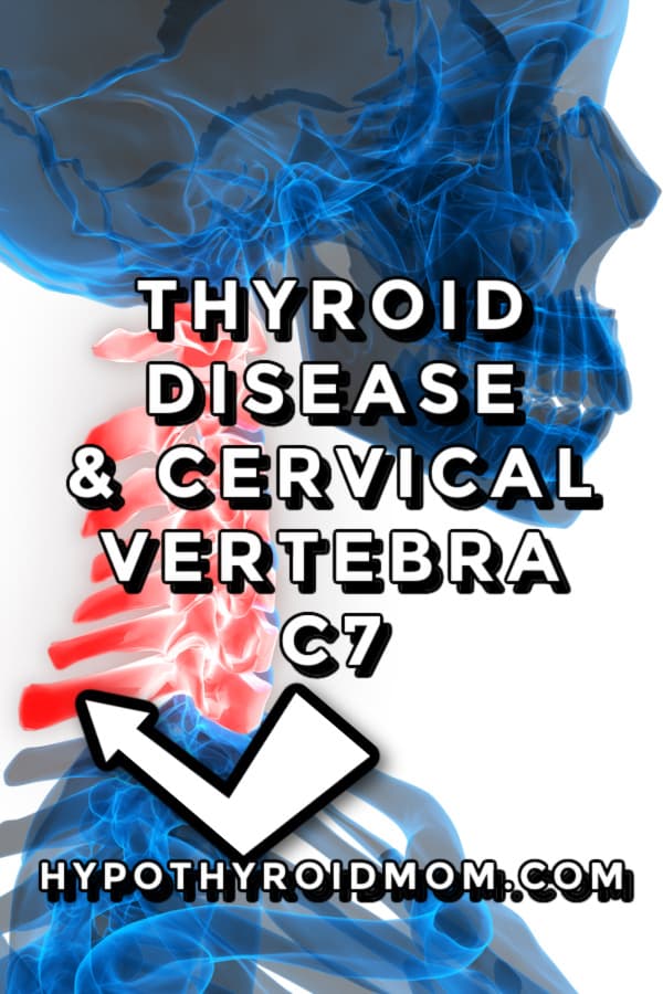 vertebra in the neck and thyroid disease