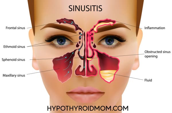 thyroid, nose, nasal cavity, paranasal sinuses