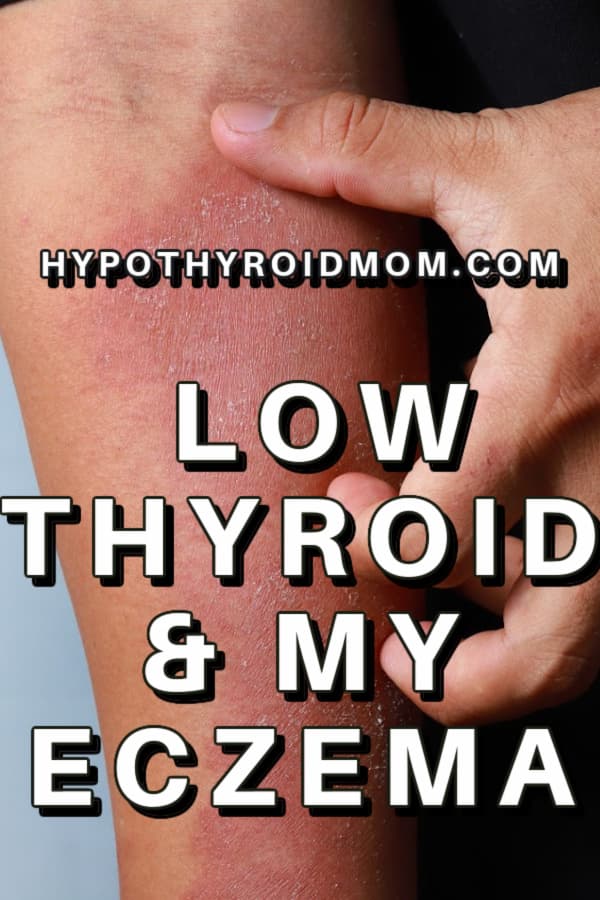low thyroid, eczema and psoriasis