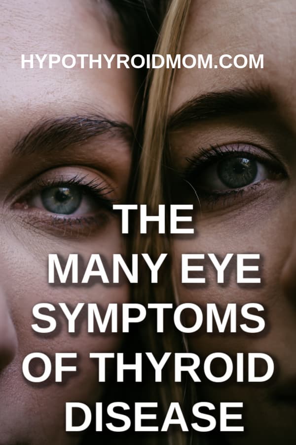 ocular eye signs of thyroid diseases