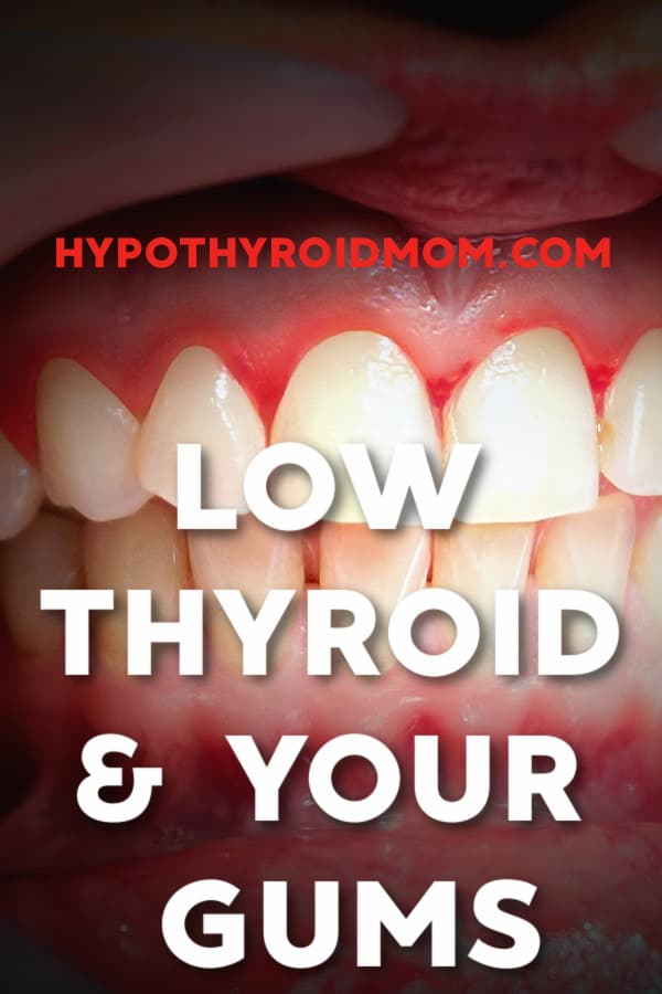 low thyroid and gum disease