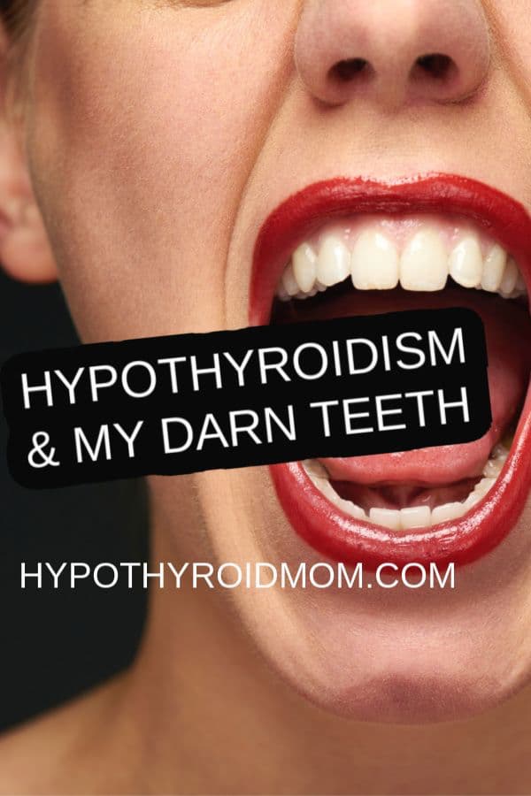 Thyroid Mouth Teeth Tongue And Throat Hypothyroid Mom