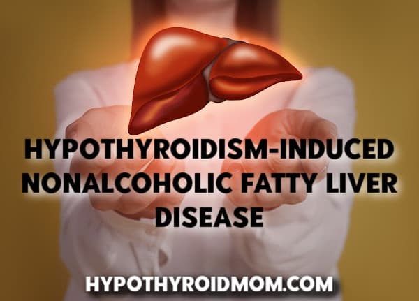 Hypothyroidism induced nonalcoholic fatty liver disease